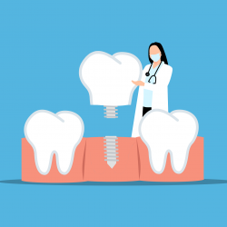 Ilustračný obrázok 323