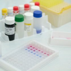 Testovací systém na zistenie prítomnosti opistorchiózy u pacienta