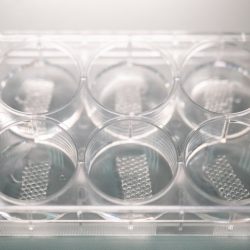 Vzorky obväzov pre ľudí s vrodenou bulóznou epidermolýzou (Epidermolysis bullosa)
